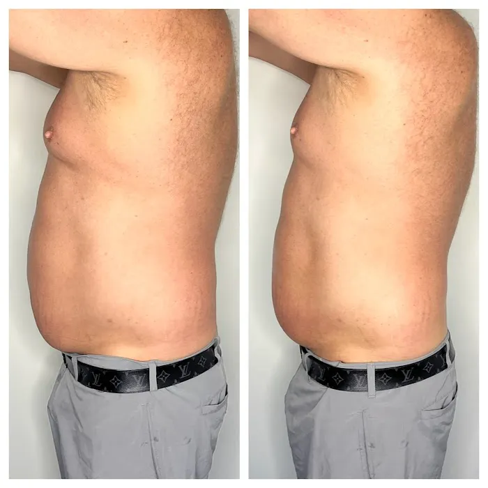 Evolve wellness center Picture 5