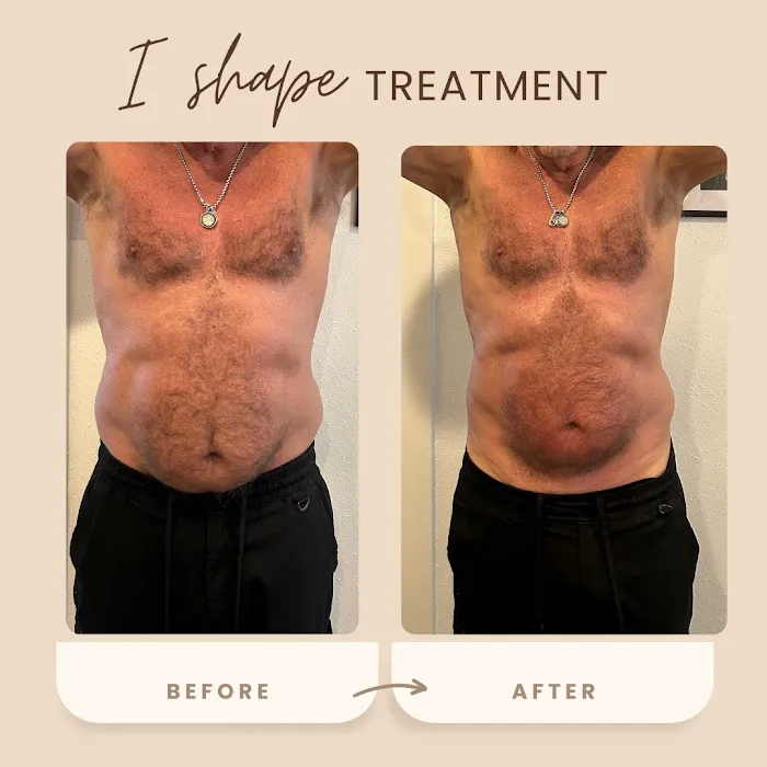 Evolve wellness center Picture 8