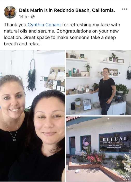 Livecynply Skin Ayurveda Picture 10