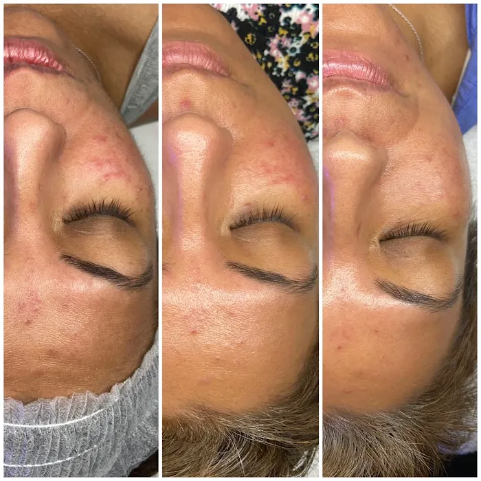 SkinLab South Bay Picture 9