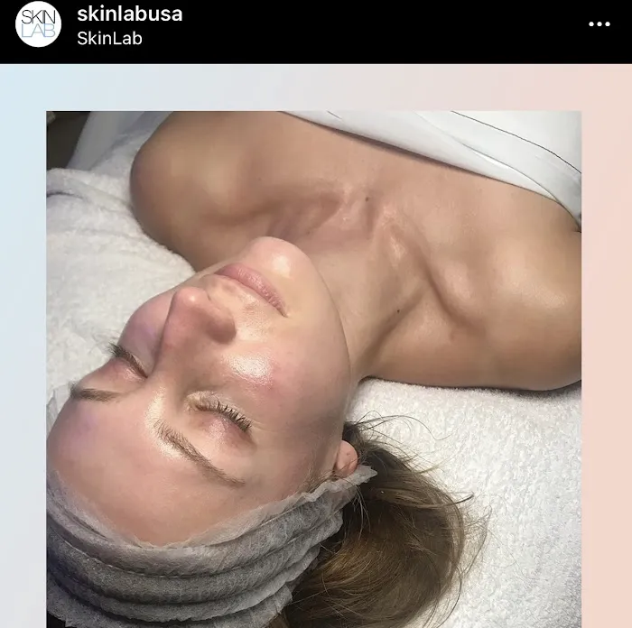 SkinLab South Bay Picture 7