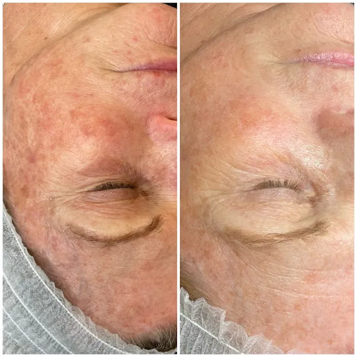 SkinLab South Bay Picture 10