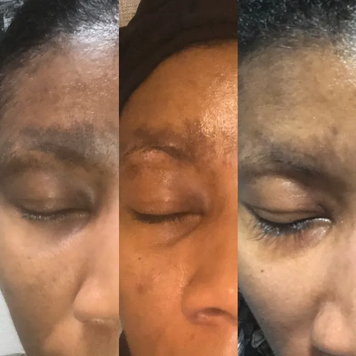 SKINbySabrina Picture 6