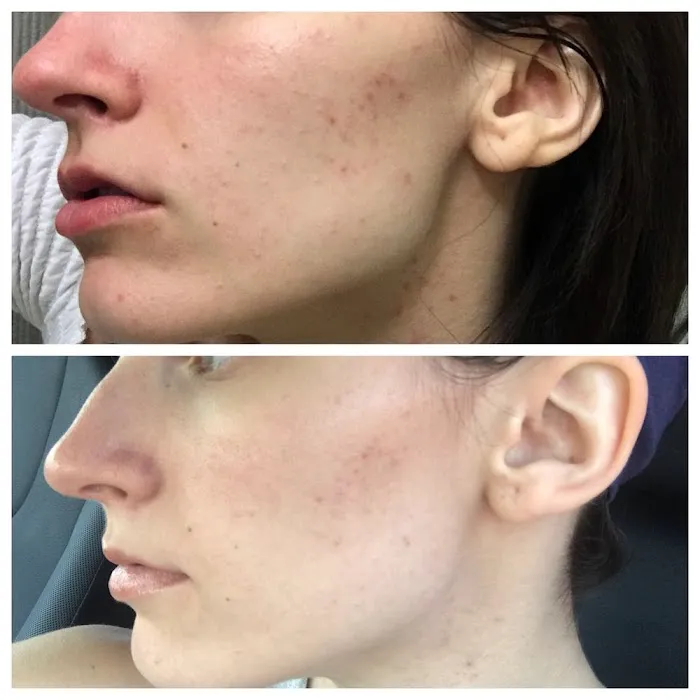 SKINbySabrina Picture 8