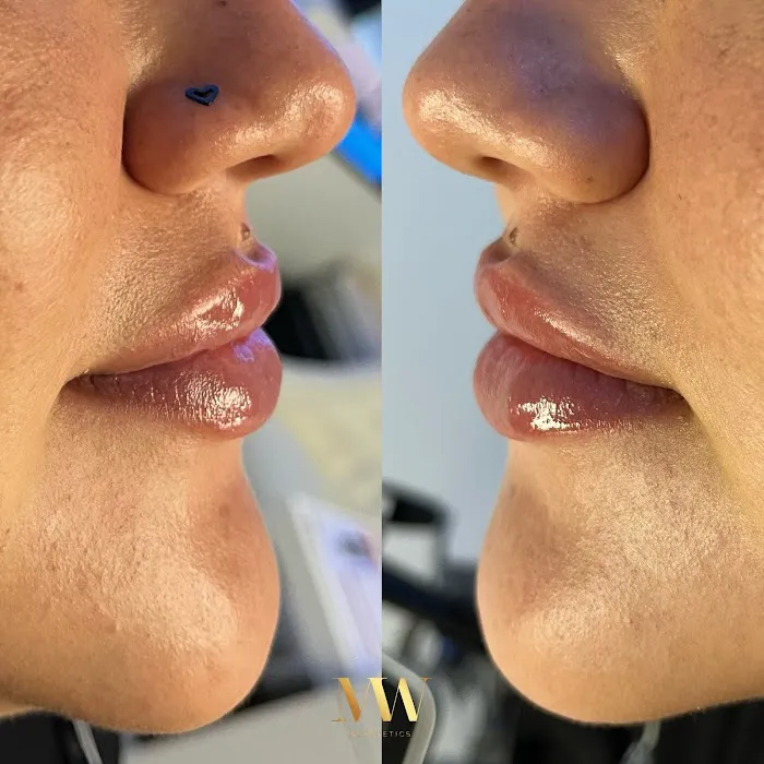 MedWell Aesthetics Picture 8