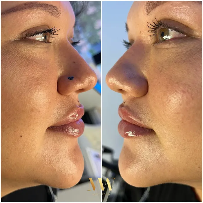 MedWell Aesthetics Picture 7