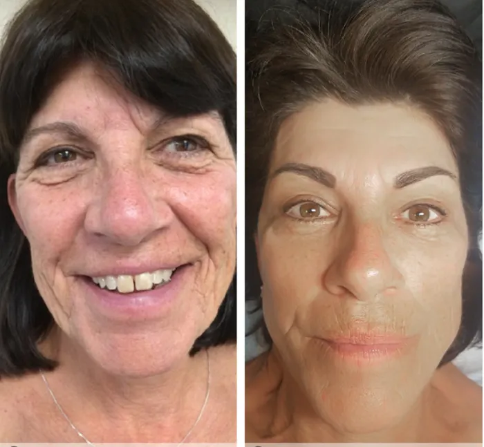 The Skin FX Picture 5