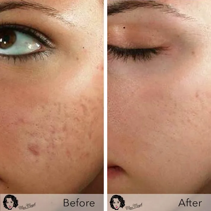 The Skin FX Picture 6