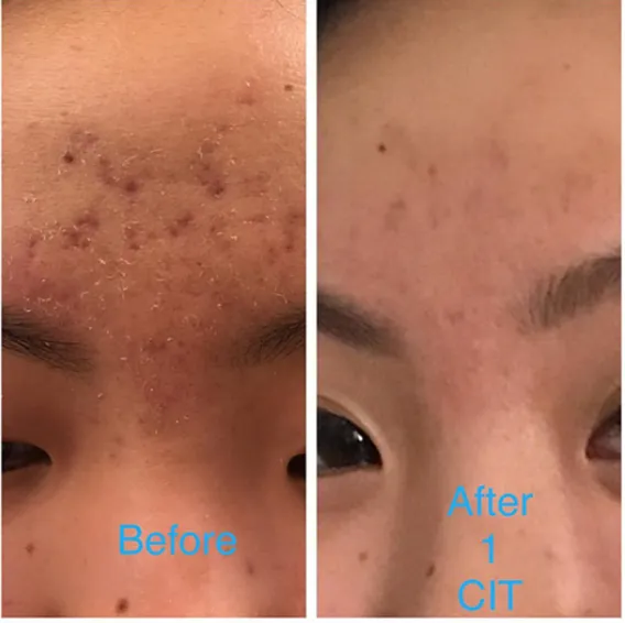 The Skin FX Picture 9