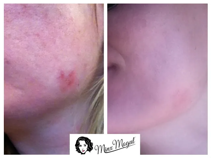 The Skin FX Picture 7