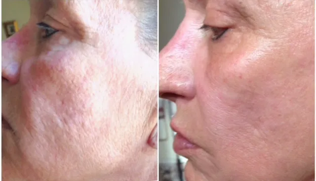 Wellness & Rejuvenation Skincare Picture 10