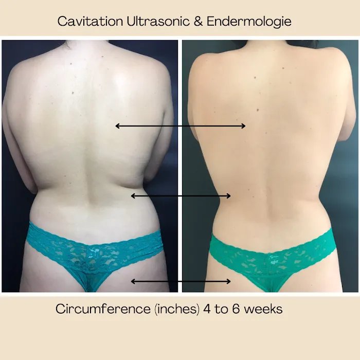 Arlene Beauty Picture 5