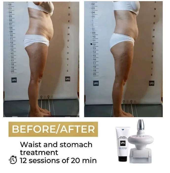 Arlene Beauty Picture 7