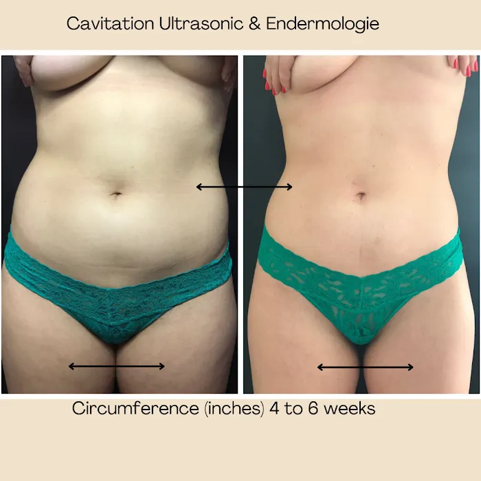 Arlene Beauty Picture 9