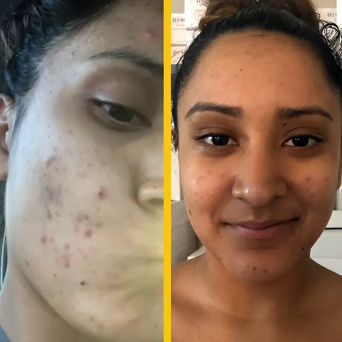 Derm by Erica Picture 10