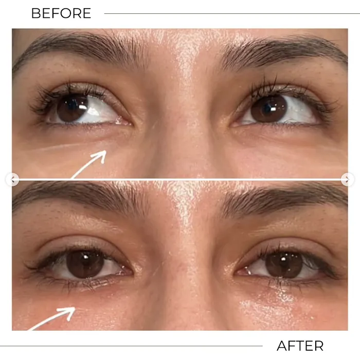 Clear Skin Therapy Picture 7