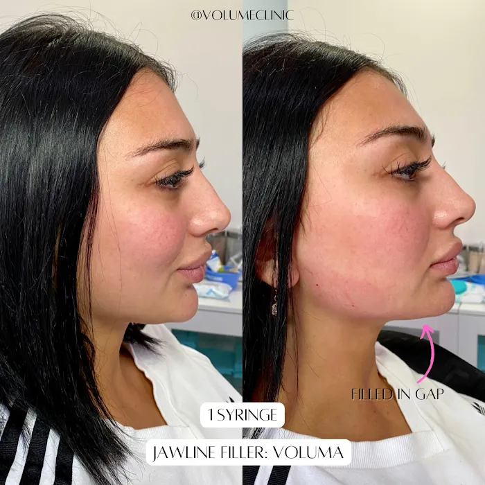 Clear Skin Therapy Picture 8