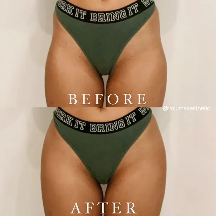 Clear Skin Therapy Picture 9