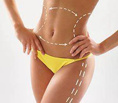 VM Cosmetic Surgery Picture 1