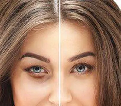 VM Cosmetic Surgery Picture 6