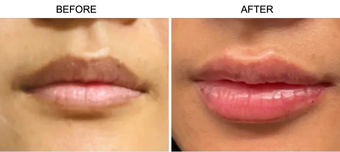 jAdore Re jVenex (JrJ) Picture 2