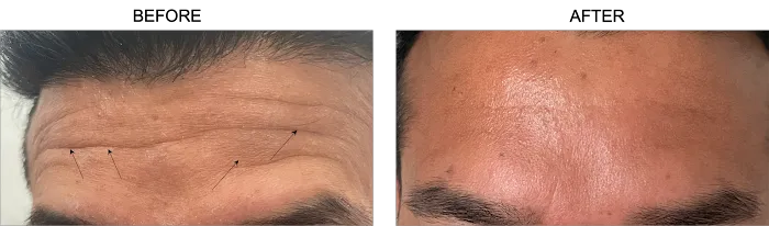 jAdore Re jVenex (JrJ) Picture 6