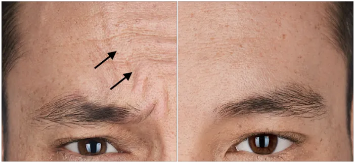 jAdore Re jVenex (JrJ) Picture 5