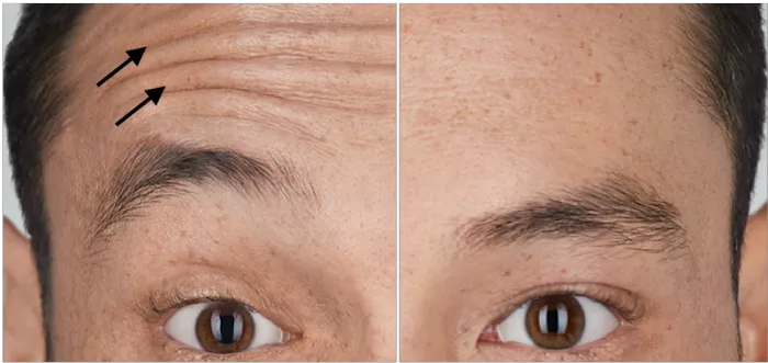 jAdore Re jVenex (JrJ) Picture 4