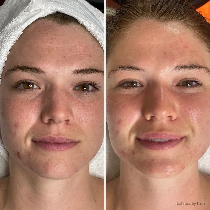 Estetica by Irina Picture 7