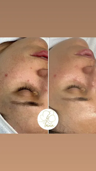 Estetica by Irina Picture 10