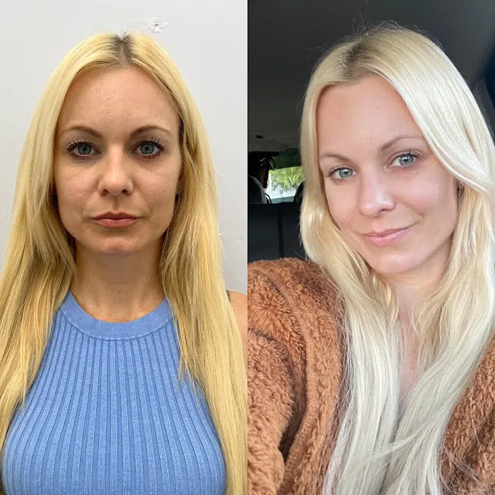 EMPATH Cryo T-Shock Picture 6