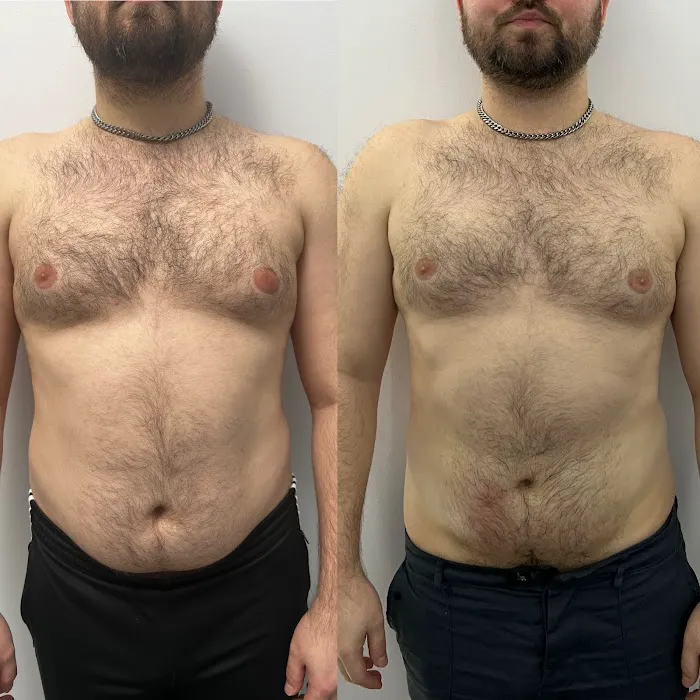 EMPATH Cryo T-Shock Picture 3