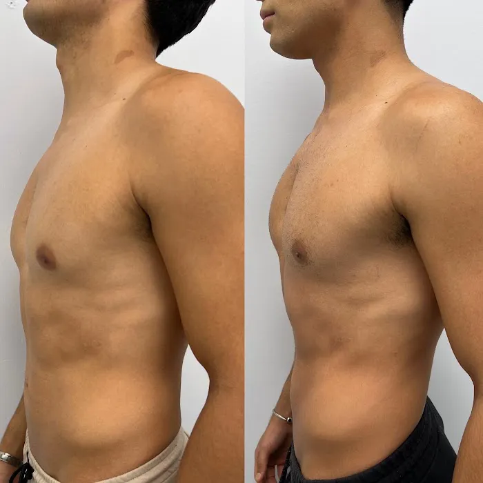 EMPATH Cryo T-Shock Picture 4