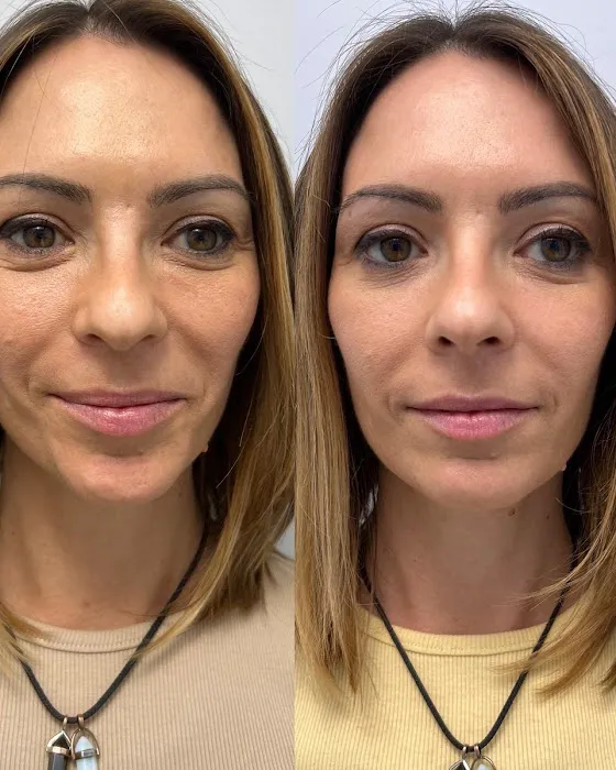 EMPATH Cryo T-Shock Picture 9