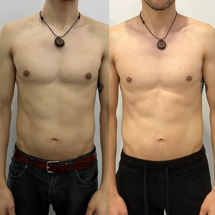 EMPATH Cryo T-Shock Picture 7