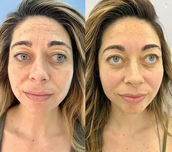 EMPATH Cryo T-Shock Picture 10