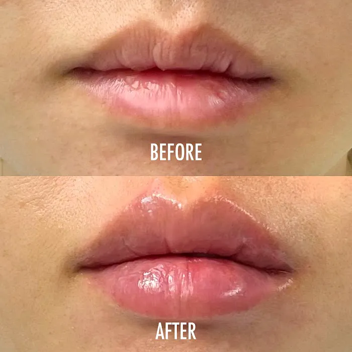 Esprit Medispa (LA) Picture 7