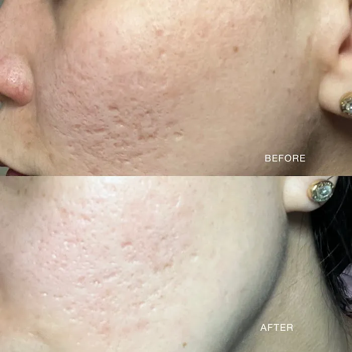 Ulica Skincare Picture 8