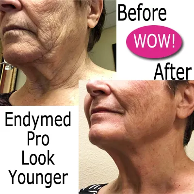 Mirabella Skin Care Picture 1