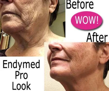 Mirabella Skin Care