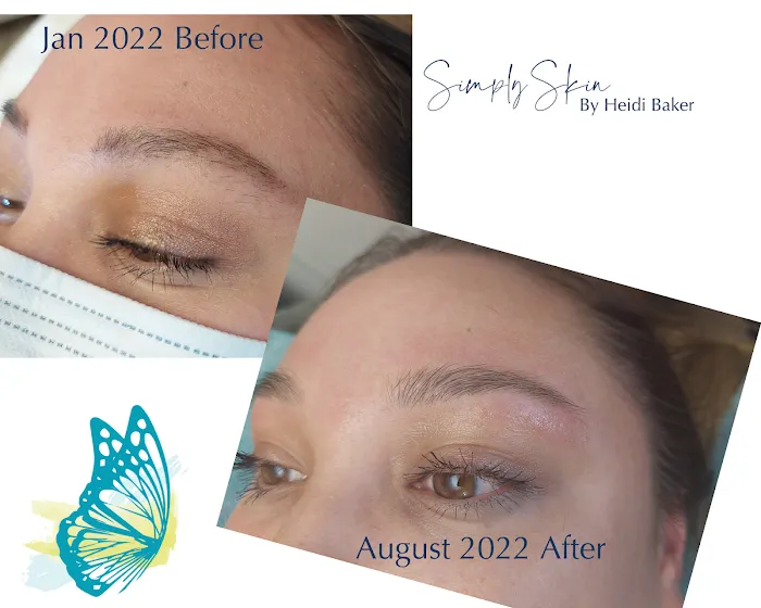 Simply Skin by Heidi Picture 9