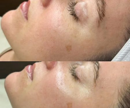 Skin & Soul - Result-Driven Facials and Waxing