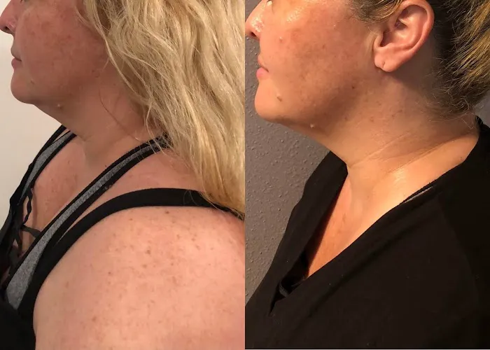 Radiant Glow Skin Care Picture 2