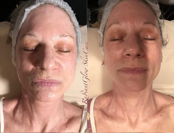 Radiant Glow Skin Care Picture 6