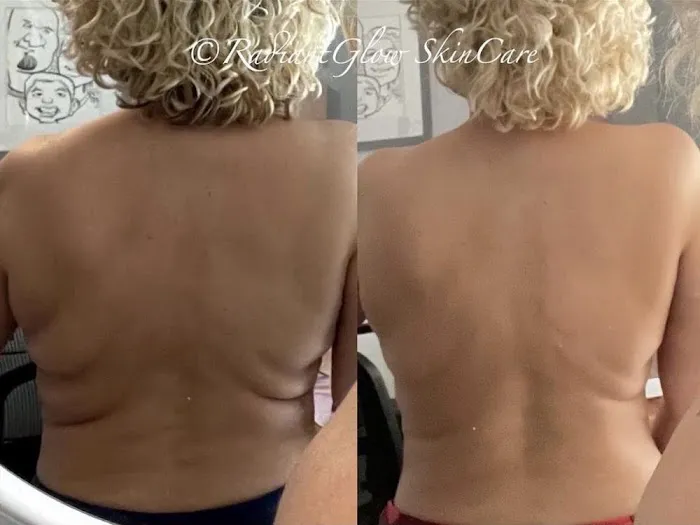 Radiant Glow Skin Care Picture 7