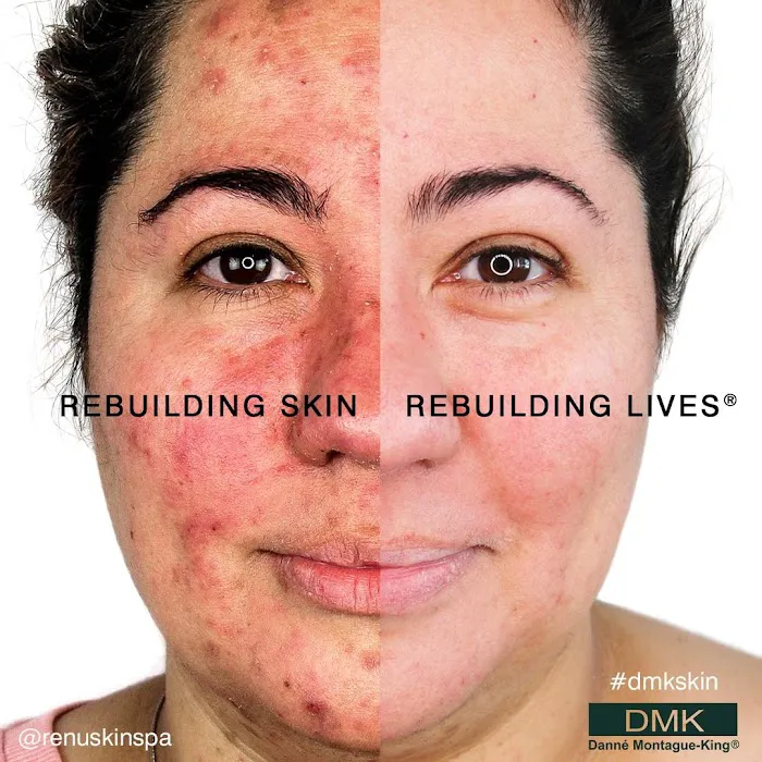 Radiant Glow Skin Care Picture 8