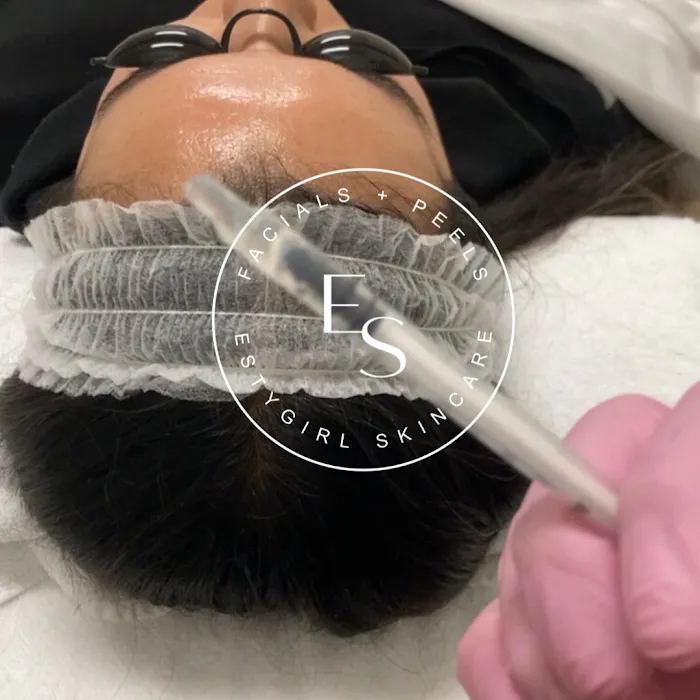 Estygirl Skincare Picture 2