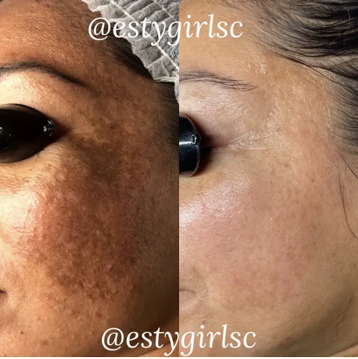 Estygirl Skincare Picture 6