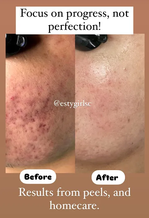 Estygirl Skincare Picture 9