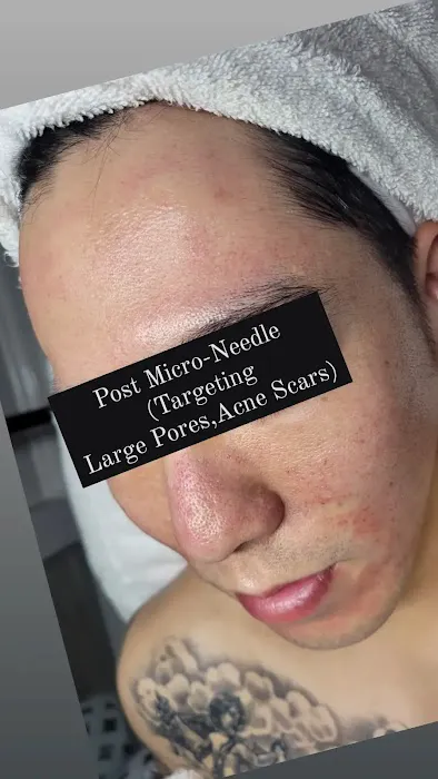 April's Body Contouring & Skincare Picture 8